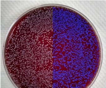 images of bacteria in petri dishes